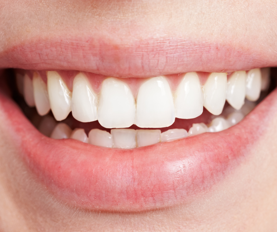 Celebrating National Save Your Tooth Month! Discover the importance of preserving natural teeth